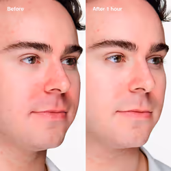 Clinique Anti-Blemish Solutions Clinical Advanced Clearing Gel Unisexe 20 ml Bouteille - Vue supplémentaire 2