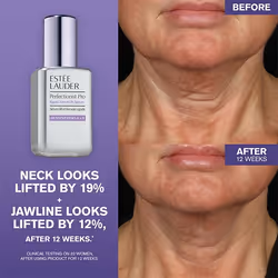 Estée Lauder Perfectionist Pro Rapid Firm + Lift Serum with Hexapeptides 8 + 9 Sérum visage 50 ml Femmes