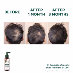 Quinine Et Edelweiss Bio sérum chute de cheveux 100 ml