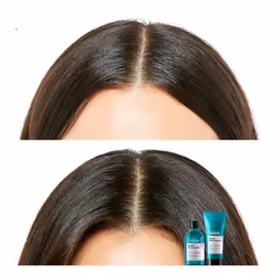 Scalp Advanced shampooing cuir chevelu sensible 500 ml