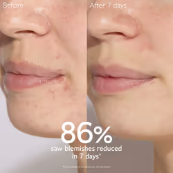 Sérum anti-imperfections Vinopure 30 ml - Vue supplémentaire 4