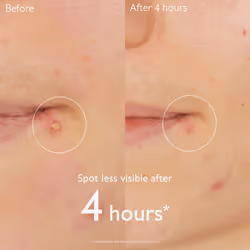 Vinopure stop boutons salicylique 15 ml - Vue supplémentaire 3