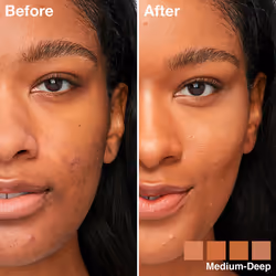 Instant Perfector Glow Polyvalent #03-moyen-profond - Vue supplémentaire 4