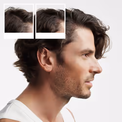 System 2 - Kit - Traitement pour cheveux naturels avec affaiblissement avancé 3 unités - Vue supplémentaire 4