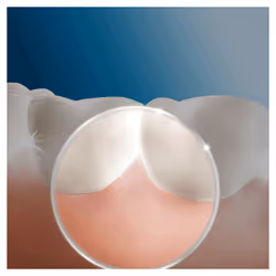Oral-B MD20 Oxyjet jet dentaire 0,6 L - Vue supplémentaire 5