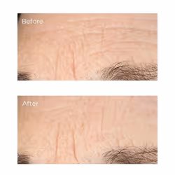 Perricone MD Essential Fx Acyl-Glutathione: Deep Crease Sérum visage 30 ml Femmes Rose - Vue supplémentaire 4