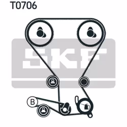 Kit distribution SKF VKMA 95005 - Vue supplémentaire 4