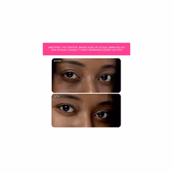 FOREO IRIS 2 Masseur yeux illuminateur approuvé par les ophtalmologistes, Magenta - Vue supplémentaire 5