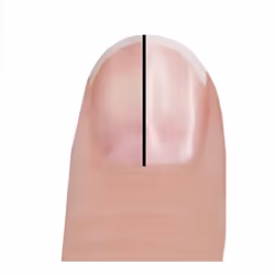 Trisa 1614.9800 Brosse à ongle désincrustante