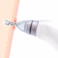 InnovaGoods 8435527816865 nettoyant pour le visage Unisexe - Vue supplémentaire 5