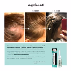Nuggela & Sulé 1401-61344 produit pour la croissance des cheveux 10 ml Unisexe