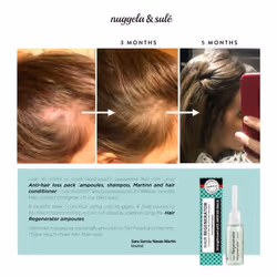 Nuggela & Sulé 1401-61559 produit pour la croissance des cheveux 10 ml Unisexe