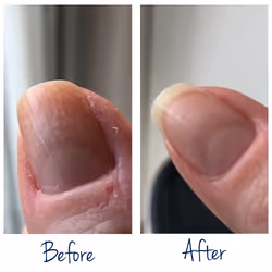 Herome Exit Damaged Nails Renforcement des ongles 7 ml