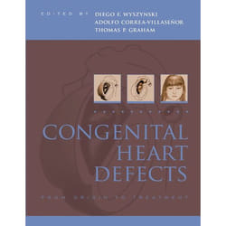 Congenital Heart Defects