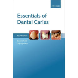 Essentials Of Dental Caries