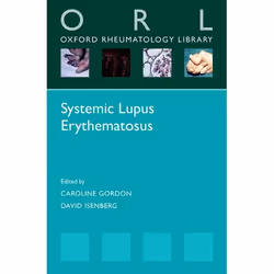 ISBN Systemic Lupus Erythematosus, Caroline Gordon, David Isenberg, 160 pages, Anglais, Oxford University Press, 10/03/2016,  ...