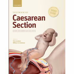 ISBN Textbook of Caesarean Section, Eric Jauniaux, William Grobman, 224 pages, Anglais, Oxford University Press, 28/04/2016,  ...