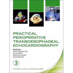ISBN Practical Perioperative Transoesophageal Echocardiography, 400 pages