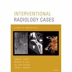 ISBN Interventional Radiology Cases, Anne M. Covey, Bradley P. Pua, Allison Aguado, David C. Madoff, Anglais, Oxford Universi ...