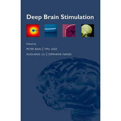 Deep Brain Stimulation