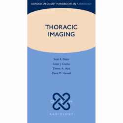 ISBN Thoracic Imaging, Sujal R. Desai, Susan J. Copley, Zelena A. Aziz, David M. Hansell, Anglais, Oxford University Press, 2 ...