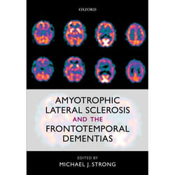 ISBN Amyotrophic Lateral Sclerosis and the Frontotemporal Dementias Anglais
