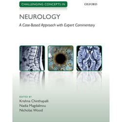Challenging Concepts in Neurology by Edited by Krishna Chinthapalli & Edited by Nadia Magdalinou & Edited by Nicholas Wood