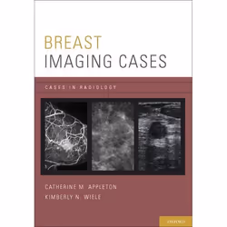 ISBN Breast Imaging Cases, Catherine M. Appleton, Kimberly N. Wiele, 272 pages, Anglais, Oxford University Press, 08/12/2011, ...
