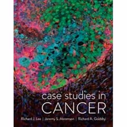 ISBN Case Studies in Cancer, Science & nature, Anglais, 306 pages