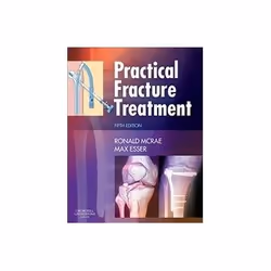 ISBN Practical Fracture Treatment 5e, Santé, esprit et corps, Anglais, 456 pages
