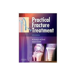 ISBN Practical Fracture Treatment 5e livre Santé, esprit et corps Anglais