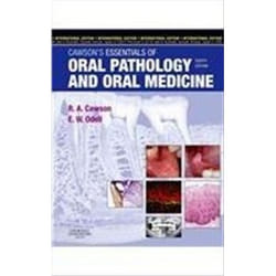 Cawson's Essentials of Oral Pathology and Oral Medicine