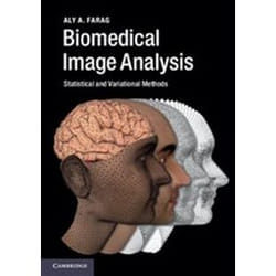 ISBN Biomedical Image Analysis : Statistical and Variational Methods livre Santé, esprit et corps Anglais Couverture rigide