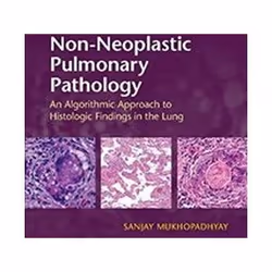 ISBN Non-Neoplastic Pulmonary Pathology with Online Resource : An Algorithmic Approach to Histologic Find, Médical, Anglais,  ...