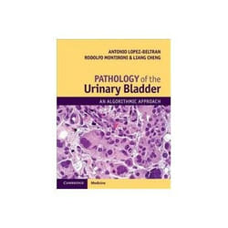 ISBN Pathology of the Urinary Bladder: An Algorithmic Approach livre Santé, esprit et corps Anglais Couverture rigide