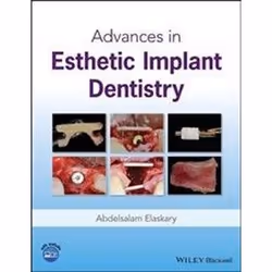 ISBN Advances in Esthetic Implant Dentistry, Education, Anglais, Couverture rigide, 584 pages