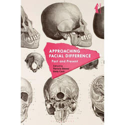 ISBN Approaching Facial Difference (Past and Present) Couverture rigide