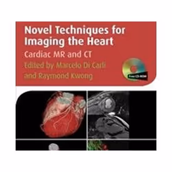 ISBN Novel Techniques for Imaging the Heart (American Heart Association Clinical Series), Médical, Anglais, Couverture rigide ...