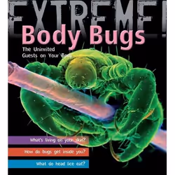 ISBN Extreme Science: Body Bugs! (The Uninvited Guests on Your Body), Anglais, Livre broché, 32 pages