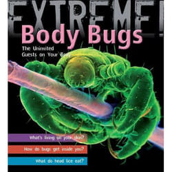 ISBN Extreme Science: Body Bugs! (The Uninvited Guests on Your Body)