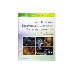 ISBN First Trimester Ultrasound Diagnosis of Fetal Abnormalities, Santé, esprit et corps, Anglais, Couverture rigide, 384 pag ...