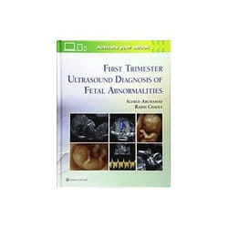 ISBN First Trimester Ultrasound Diagnosis of Fetal Abnormalities livre Santé, esprit et corps Anglais Couverture rigide
