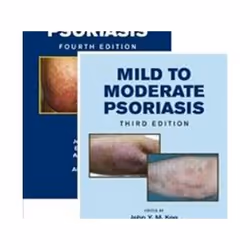 ISBN Mild to Moderate and Moderate to Severe Psoriasis, Médical, Anglais, Couverture rigide, 564 pages