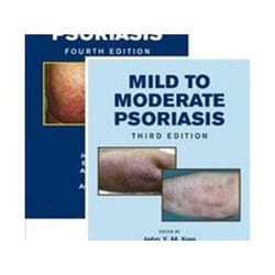 ISBN Mild to Moderate and Moderate to Severe Psoriasis livre Médical Anglais Couverture rigide