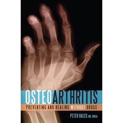 ISBN Osteoarthritis livre nourriture & boisson Anglais