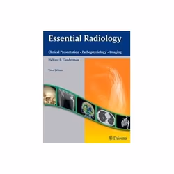 ISBN Essential Radiology: Clinical Presentation Pathophysiology Imaging 3e, Santé, esprit et corps, Anglais, 352 pages