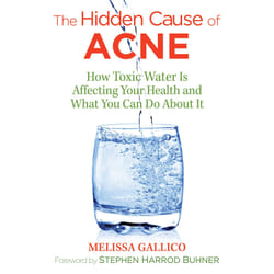 ISBN The Hidden Cause of Acne Livre de poche