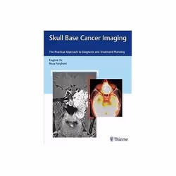 ISBN Skull Base Cancer Imaging: The Practical Approach to Diagnosis and Treatment Planning, Santé, esprit et corps, Anglais,  ...