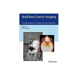 Skull Base Cancer Imaging: The Practical Approach To Diagnosis And Treatment Planning