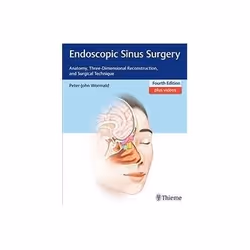 ISBN Endoscopic Sinus Surgery: Anatomy, Three-Dimensional Reconstruction, and Surgical Technique, Santé, esprit et corps, Ang ...